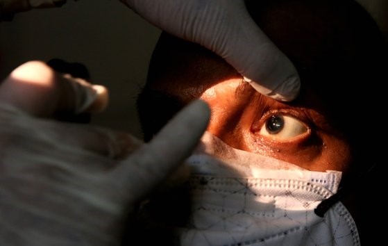 正在接受眼球诊查的黑真菌症疑似患者。此类患者病情恶化时或需要摘除眼球。【新华社=韩联社】